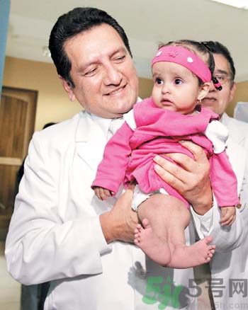 媽媽懷上人魚寶寶 什么是美人魚綜合癥？