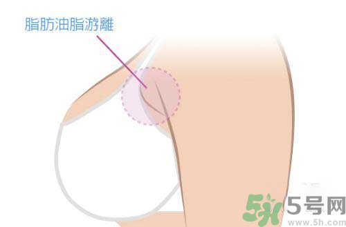 副乳是什么？副乳的危害