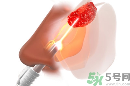 鼻咽癌的日常措施是什么？鼻咽癌注意的飲食有哪些？