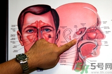 鼻咽癌的發(fā)病因素是什么？鼻咽癌的并發(fā)癥有哪些？