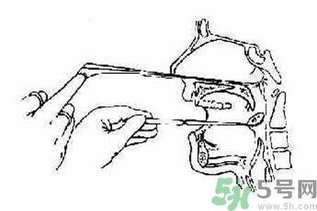 鼻咽癌的高發(fā)人群有哪些？如何預(yù)防鼻咽癌？