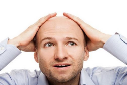 男人禿頂能治好嗎？治療禿頂小偏方