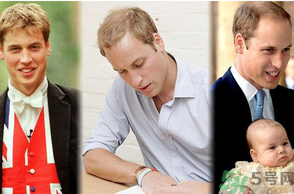 男人禿頂會遺傳嗎？男人禿頂是腎虛嗎？