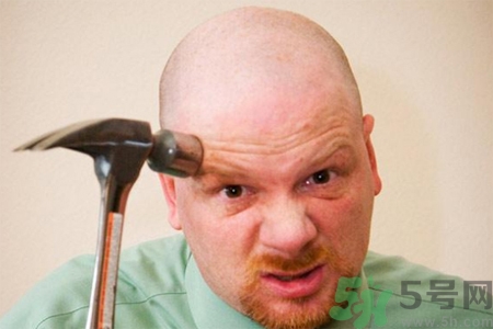 脫發(fā)的高發(fā)人群有哪些？如何預(yù)防脫發(fā)？