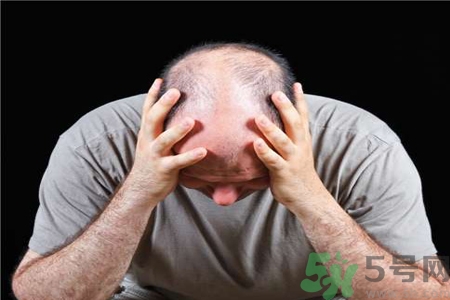 脫發(fā)的高發(fā)人群有哪些？如何預(yù)防脫發(fā)？