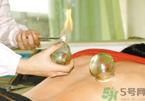 拔火罐和拔氣罐哪個好？拔火罐和拔氣罐的區(qū)別