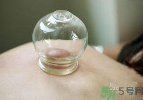 拔火罐和拔氣罐哪個好？拔火罐和拔氣罐的區(qū)別