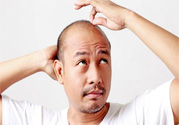 脫發(fā)的高發(fā)人群有哪些？如何預防脫發(fā)？