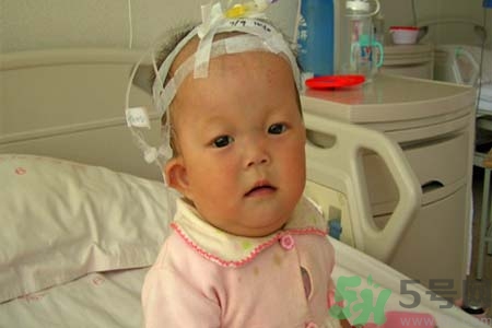 先天性心臟病可以用藥物治療嗎？