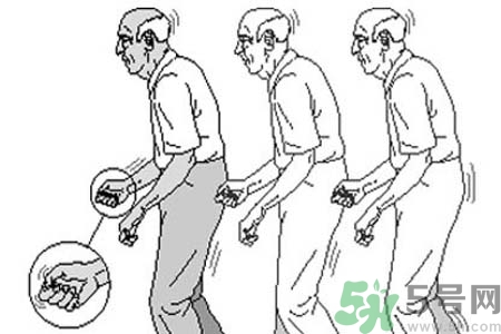 帕金森要注意哪些措施？帕金森的飲食需注意什么？