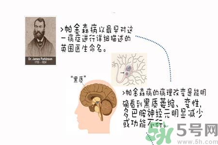 帕金森的治療方法有哪些？