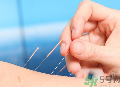 埋線減肥多少錢一次？埋線減肥的副作用