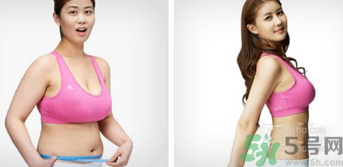 埋線減肥多少錢一次？埋線減肥的副作用