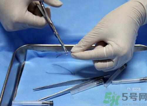 埋線減肥多少錢一次？埋線減肥的副作用