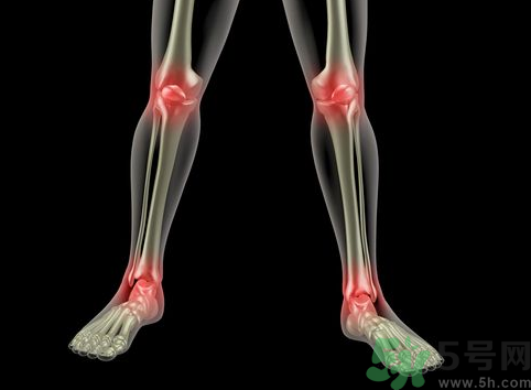 下雨天關(guān)節(jié)痛是怎么回事？下雨天關(guān)節(jié)疼痛是風(fēng)濕性關(guān)節(jié)炎嗎？