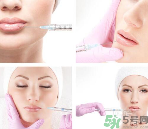 膠原蛋白注射價(jià)格 膠原蛋白注射效果 膠原蛋白注射價(jià)格 膠原蛋白注射效果