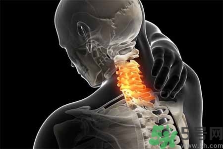 為什么年輕人容易得頸椎??？頸椎病嚴(yán)重的癥狀有哪些？