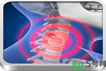 為什么年輕人容易得頸椎?。款i椎病嚴(yán)重的癥狀有哪些？