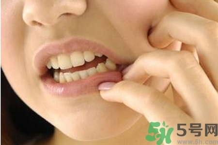 天熱牙疼要注意什么？天熱牙疼什么原因？