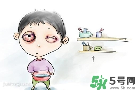 寶寶為什么會感染紅眼?。繉殞毣技t眼病如何治療？