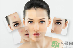 下巴長硬包是怎么回事？下巴長硬包怎么辦？