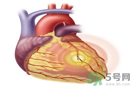 長期酗酒會引起心絞痛嗎？引起心絞痛的原因有哪些？