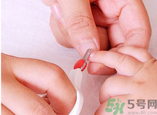 寶寶長蘚是怎么回事？寶寶長蘚怎么辦？