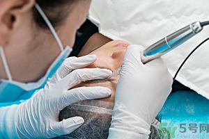 光子嫩膚可以去疤嗎？光子嫩膚能去皺紋嗎？