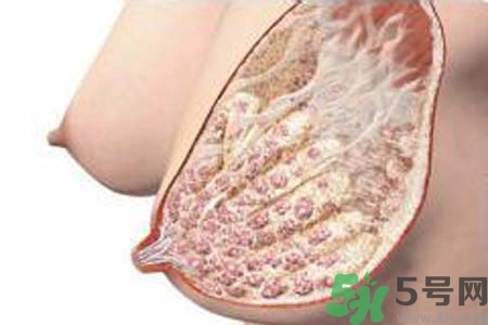 乳腺增生治療方法是什么？乳腺增生的檢查方法有哪些？