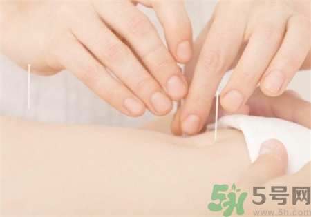 針灸后能洗澡嗎?針灸后多久可以洗澡? 針灸后能洗澡嗎?針灸后多久可以洗澡?