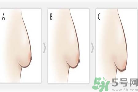 胸部松弛的原因是什么？胸部松弛該怎么辦？