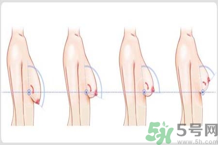 如何預(yù)防胸部松弛？吃什么能使胸部挺拔？