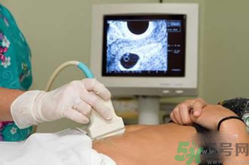 孕婦做b超要空腹嗎？孕婦做b超要不要空腹？