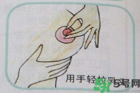 乳頭內(nèi)陷怎么矯正？乳頭內(nèi)陷矯正方法是什么？