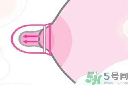 乳頭內(nèi)陷能不能喂奶？乳頭凹陷怎樣哺乳？
