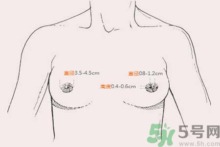 乳頭內(nèi)陷能不能喂奶？乳頭凹陷怎樣哺乳？