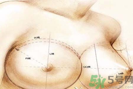 乳頭內(nèi)陷可以用吸奶器嗎？乳頭內(nèi)陷能不能用吸奶器？