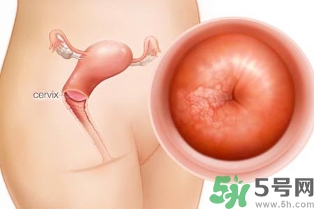 陰道干澀是什么？陰道干澀的危害有什么？