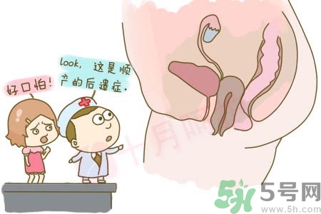 女性陰道松弛的原因是什么？女性陰道松弛怎么辦？