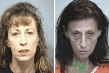 抗衰老的癥狀有哪些？抗衰老的表現(xiàn)是什么？