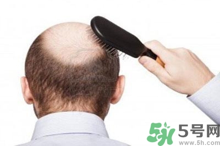 男性防止性衰老決竅有哪些？男性受用一生抵抗衰老法則