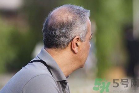 男性更年期的表現(xiàn)有哪些？怎么判斷男性更年期？