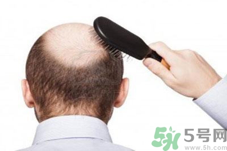 男性更年期的治療方法有哪些？如何預防男性更年期？