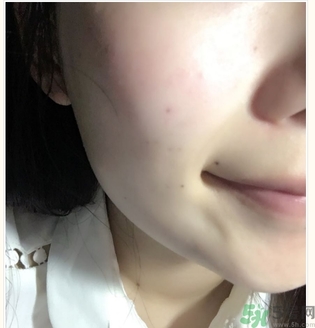 麗得姿面膜適合孕婦可以用嗎？麗得姿面膜哪些孕婦可以用？