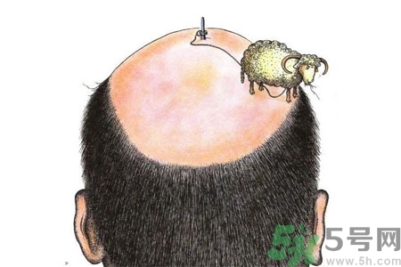 頭發(fā)稀少的原因是什么？如何預(yù)防禿頂?shù)陌l(fā)生？