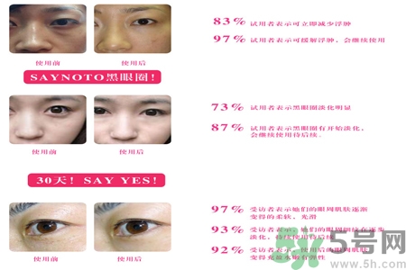 自然之名雪玫瑰雪蒸汽眼霜適合什么年齡？自然之名雪玫瑰雪蒸汽眼霜價格多少？