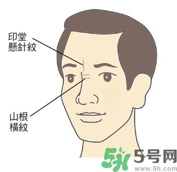 耳垂上有豎紋是怎么回事？山根有橫紋是什么??？