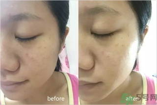 rilastil面膜使用方法 維納斯蒂爾面膜怎么用？