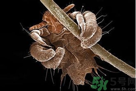 引起外陰瘙癢的疾病有哪些？治療外陰瘙癢的偏方有哪些？