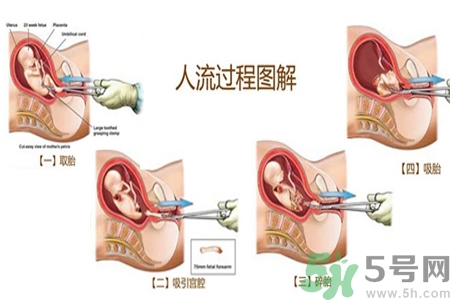 人流后怎么調(diào)養(yǎng)身體？人流后飲食需注意什么？